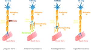 Understanding Nerve Regeneration: Mechanisms and Implications